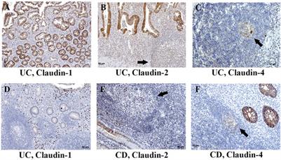 Claudins: Beyond Tight Junctions in Human IBD and Murine Models